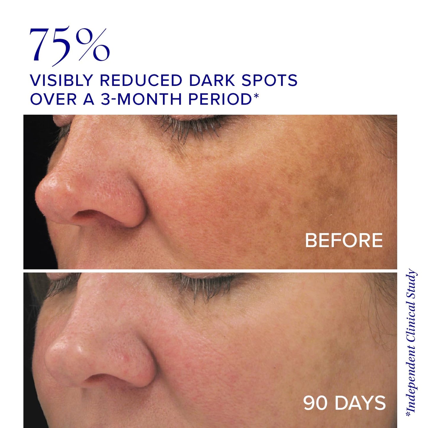 iS Clinical Brightening Complex