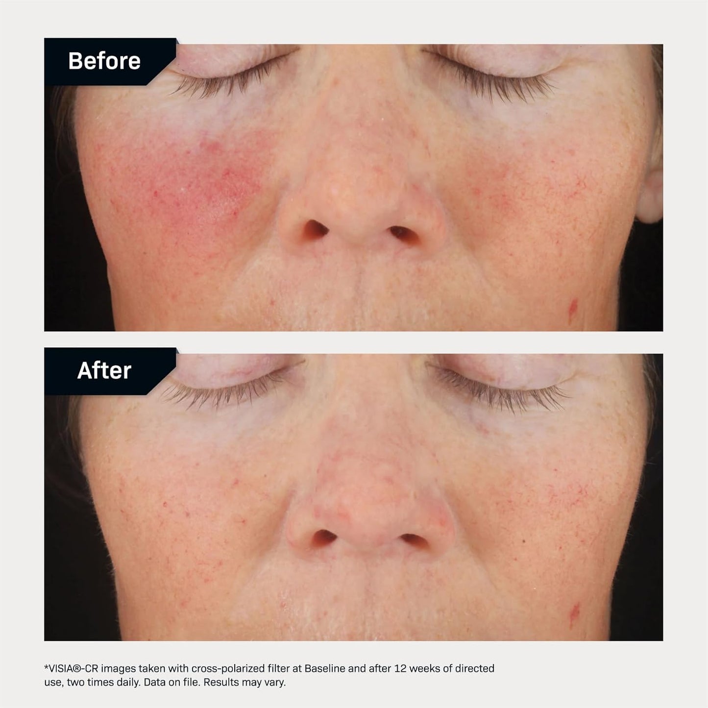 Revision Skincare C+ Correcting Complex 30%