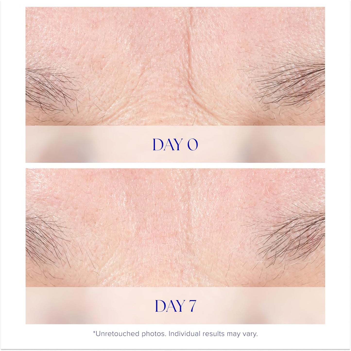 iS CLINICAL Youth Intensive Crème