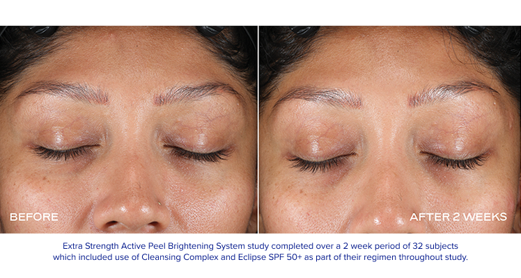 iS Clinical Extra Strength Active Peel Brightening System