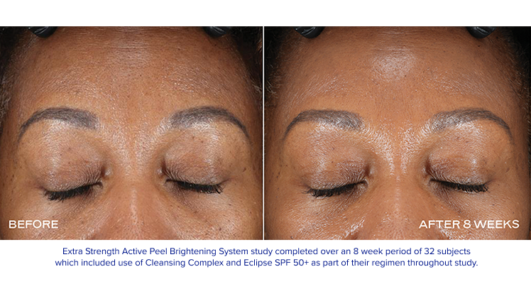 iS Clinical Extra Strength Active Peel Brightening System