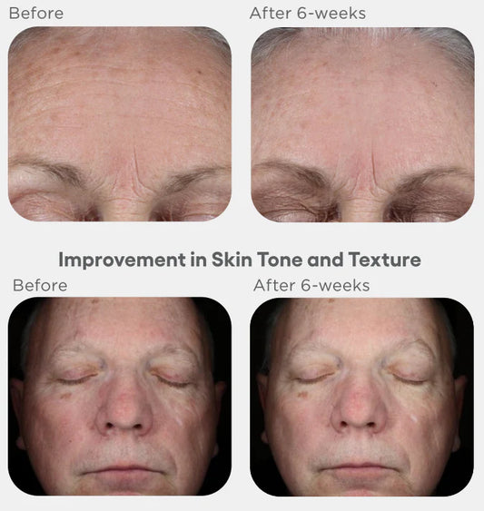 (plated) Skin Science INTENSE Serum