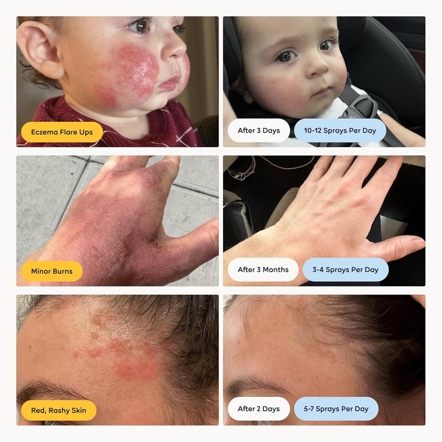 MAGIC MOLECULE Hypochlorus Skin Cleanser for All Types
